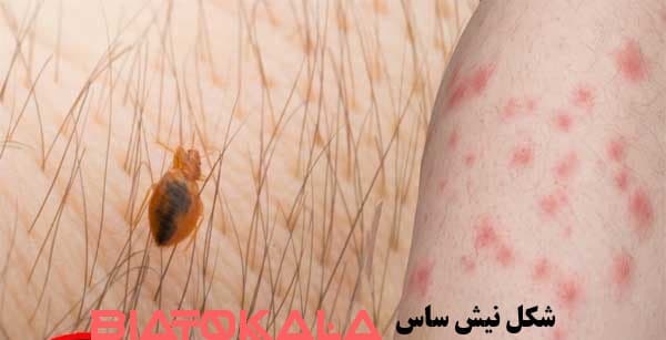 نیش ساس